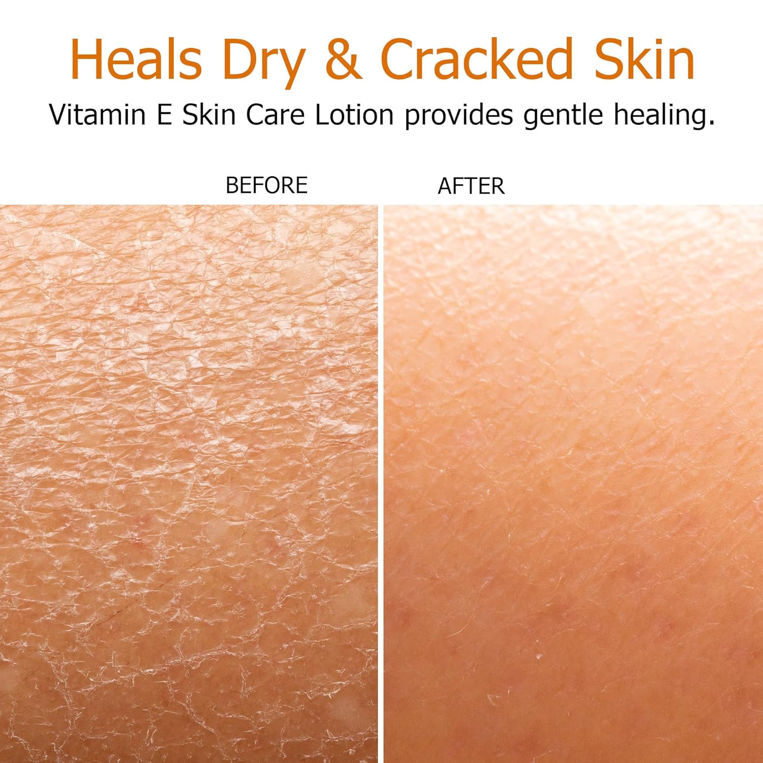 Fruit of the Earth, Vitamin E Lotion, 16 oz